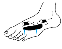 brainlet foot face 