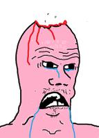 brainlet pink drooling 