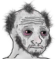 wojak doomer male pattern baldness 